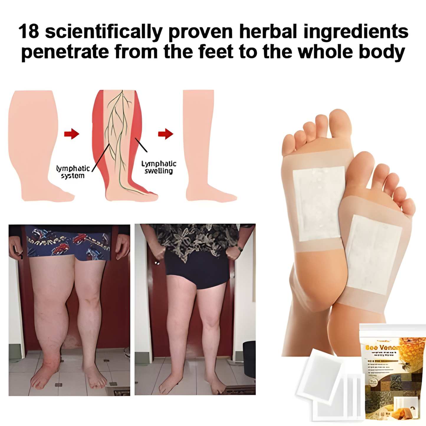 Vee Vesom Lymphatic Daiamage & Sliming Patches